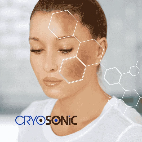 Are you looking for age spot removal treatment? Contact Cryosonic today in Crawley