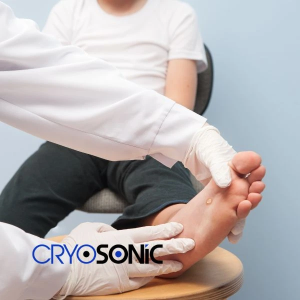 Are you looking for fast effective wart removal Contact us today Crawley