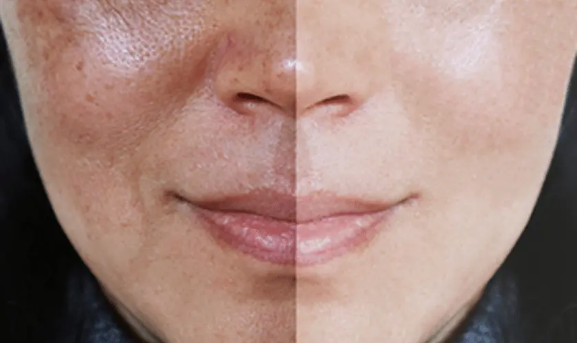 What Lifestyle Changes Support Skin Repair Crawley? Crawley